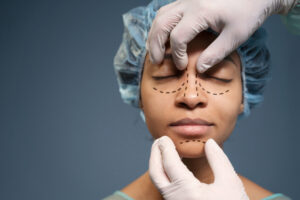 rhinoplasty